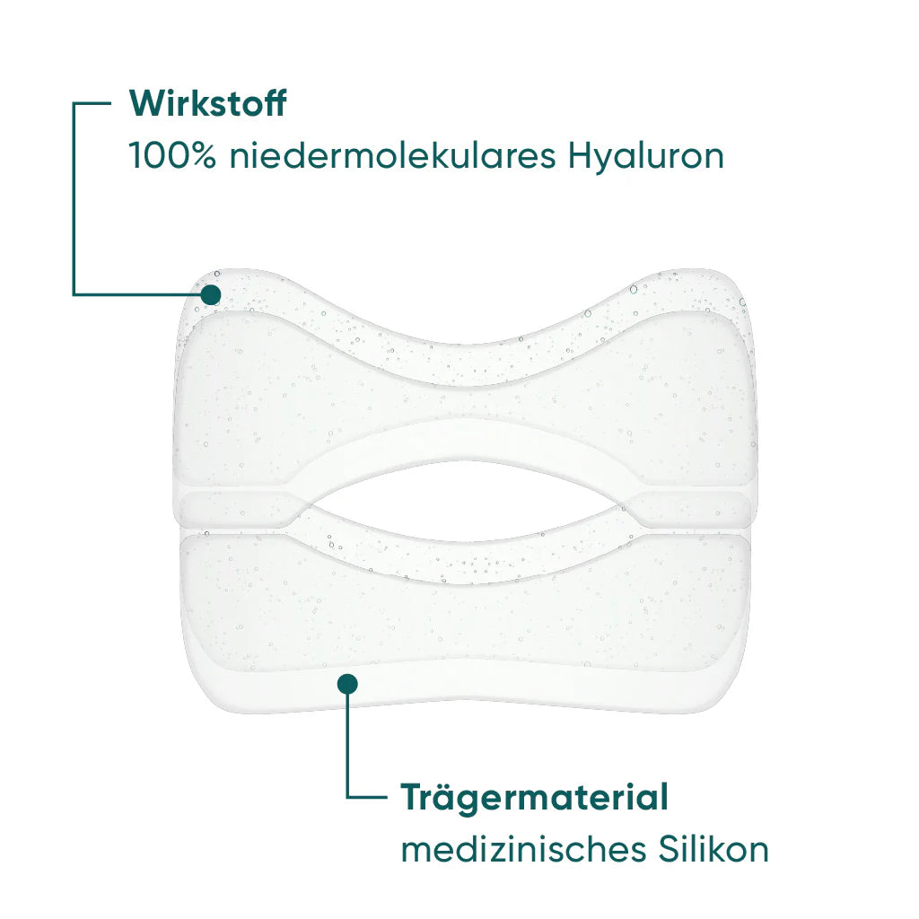 Nasolabial Pads mit Hyaluron